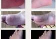 脚上如何分辨是湿疹还是脚气（脚上怎么分辨是湿疹还是过敏）
